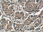 RANKL Antibody in Immunohistochemistry (Paraffin) (IHC (P))