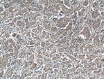 RANKL Antibody in Immunohistochemistry (Paraffin) (IHC (P))