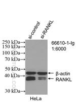 RANKL Antibody in Western Blot (WB)