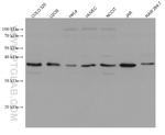 RANKL Antibody in Western Blot (WB)