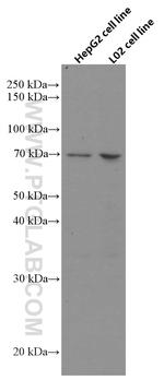ND5 Antibody in Western Blot (WB)