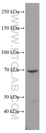 ND5 Antibody in Western Blot (WB)