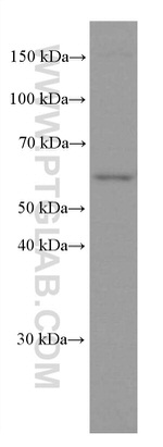 PPP3CB Antibody in Western Blot (WB)