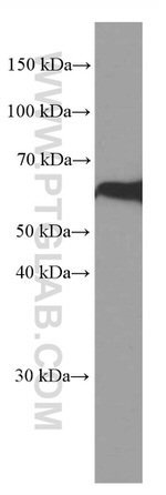 PPP3CB Antibody in Western Blot (WB)