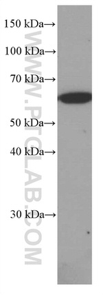 PPP3CB Antibody in Western Blot (WB)