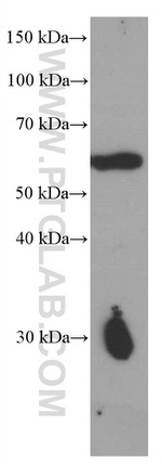 PPP3CB Antibody in Western Blot (WB)