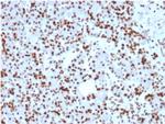 SOX9/SRY-box 9 Monoclonal Antibody (SOX9, 2398)