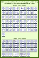 SOX9/SRY-box 9 Recombinant Rabbit Monoclonal Antibody (MSVA-709R)
