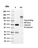 SOX9/SRY-box 9 Antibody in SDS-PAGE (SDS-PAGE)