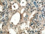RABEPK/p40 Antibody in Immunohistochemistry (Paraffin) (IHC (P))