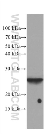 GSTA1 Antibody in Western Blot (WB)