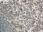 cIAP1 Antibody in Immunohistochemistry (Paraffin) (IHC (P))