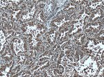 cIAP1 Antibody in Immunohistochemistry (Paraffin) (IHC (P))