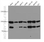 ACTN4 Antibody in Western Blot (WB)