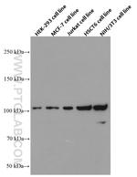 ACTN4 Antibody in Western Blot (WB)