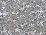 ACTN4 Antibody in Immunohistochemistry (Paraffin) (IHC (P))