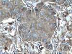 ACTN4 Antibody in Immunohistochemistry (Paraffin) (IHC (P))