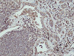 ACTN4 Antibody in Immunohistochemistry (Paraffin) (IHC (P))