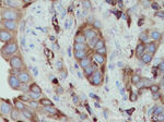 ACTN4 Antibody in Immunohistochemistry (Paraffin) (IHC (P))