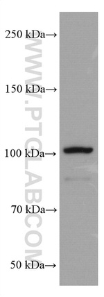 ACTN4 Antibody in Western Blot (WB)