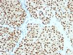 SOX10 (Melanoma Marker) Monoclonal Antibody (SOX10/991)