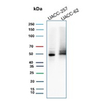 SOX10 (Melanoma Marker) Antibody in Western Blot (WB)