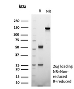 SOX10 (Melanoma Marker) Antibody in SDS-PAGE (SDS-PAGE)