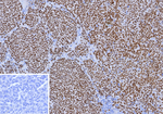 SOX10 (Melanoma Marker) Antibody in Immunohistochemistry (Paraffin) (IHC (P))