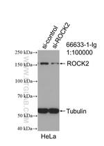 ROCK2 Antibody in Western Blot (WB)