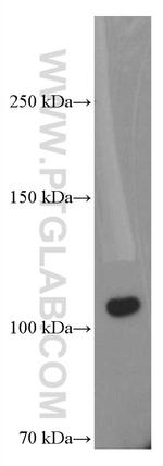 C5 Antibody in Western Blot (WB)