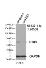 STK3 Antibody in Western Blot (WB)