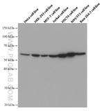 STK3 Antibody in Western Blot (WB)