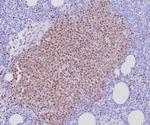 SOX11 (Mantle Cell Lymphoma Marker) Monoclonal Antibody (SOX11/7236)