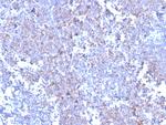 SOX11 (Mantle Cell Lymphoma Marker) Recombinant Rabbit Monoclonal Antibody (SOX11/3235R)