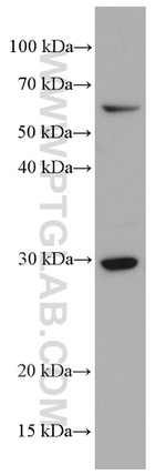 CD302 Antibody in Western Blot (WB)