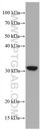 CD302 Antibody in Western Blot (WB)