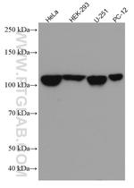ANLN Antibody in Western Blot (WB)