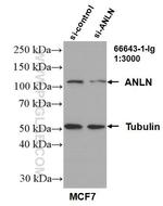 ANLN Antibody in Western Blot (WB)