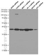 IGFBP2 Antibody in Western Blot (WB)