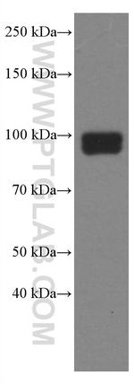 TLR2 Antibody in Western Blot (WB)