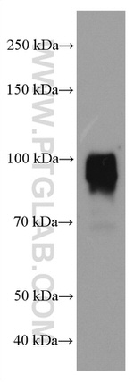 TLR2 Antibody in Western Blot (WB)