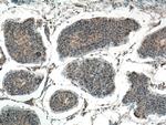 EIF2AK2 Antibody in Immunohistochemistry (Paraffin) (IHC (P))