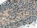 EIF2AK2 Antibody in Immunohistochemistry (Paraffin) (IHC (P))