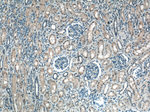 EIF2AK2 Antibody in Immunohistochemistry (Paraffin) (IHC (P))