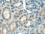 EIF2AK2 Antibody in Immunohistochemistry (Paraffin) (IHC (P))