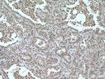 CEBPB Antibody in Immunohistochemistry (Paraffin) (IHC (P))