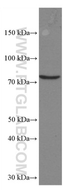 RASGRP3 Antibody in Western Blot (WB)