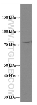 RASGRP3 Antibody in Western Blot (WB)