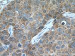 EIF4E Antibody in Immunohistochemistry (Paraffin) (IHC (P))
