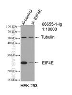 EIF4E Antibody in Western Blot (WB)